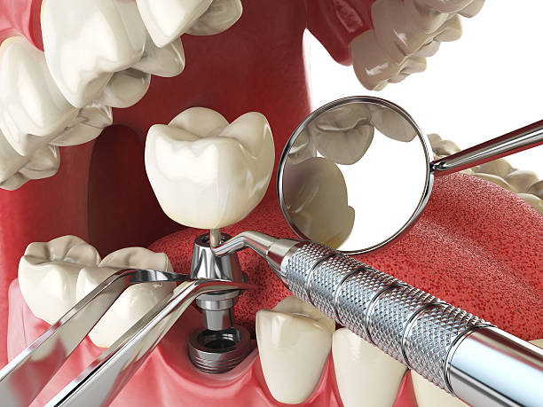 Fast & Reliable Emergency Dental Services in IN